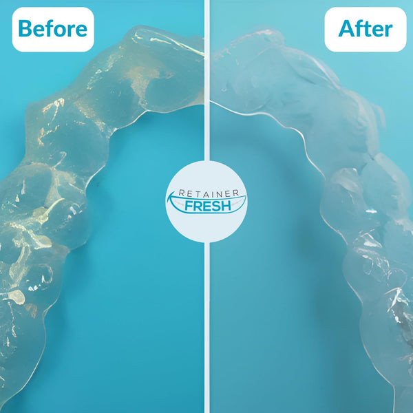 Retainer Cleaner Tablets Retainer Fresh Keeps Your Retainer Brite